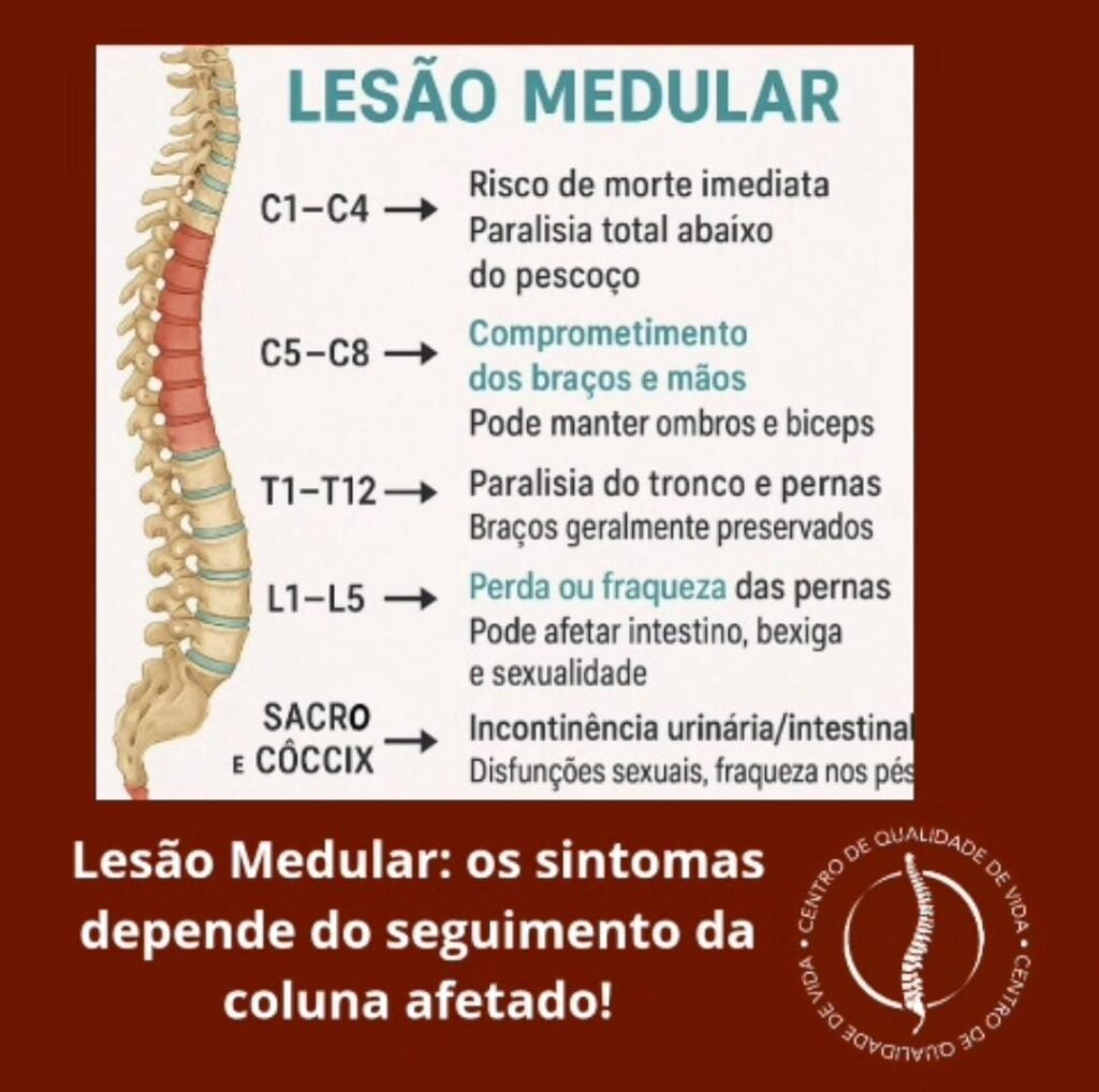 Lesão Medular – Visão Geral e Segmentos da Medula Espinhal – Centro de ...